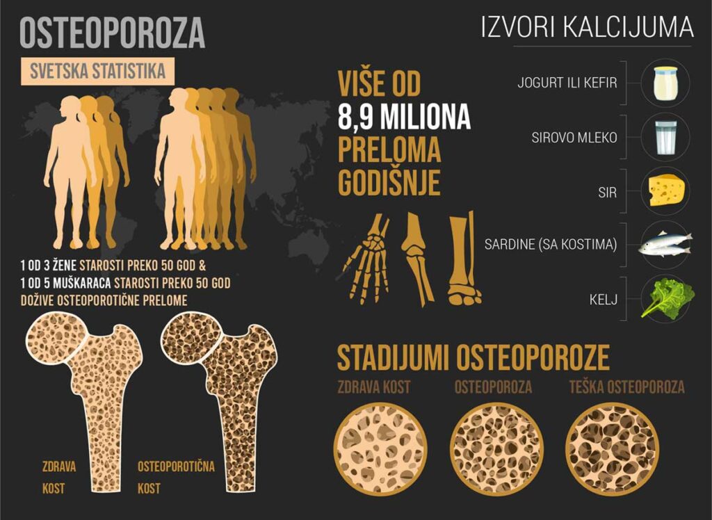 Osteoporoza infografika